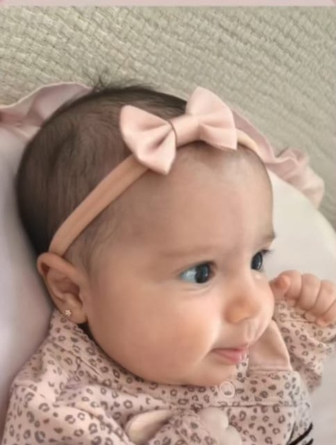 Assimetria das orelhas do bebê: é normal?