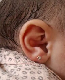 Orelha direita da bebê com a marcação feita pela anatomia